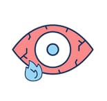 Itchy or burning eyes