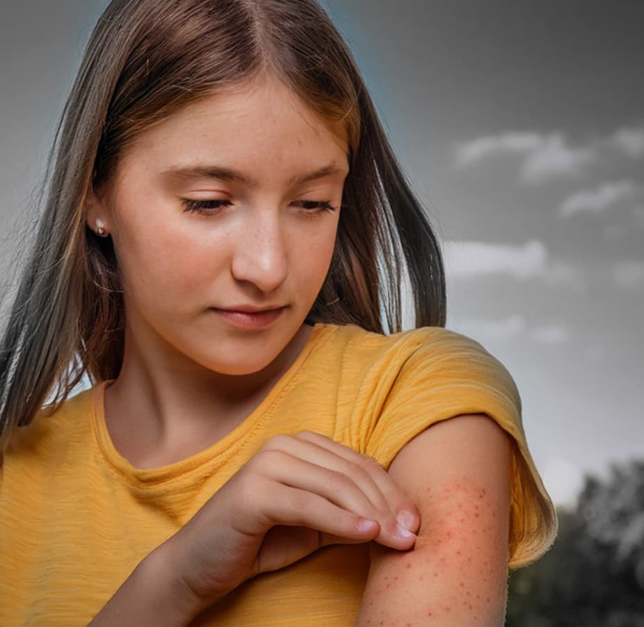 Skin Rash Hero